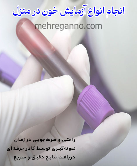 انجام آزمایش خون در منزل