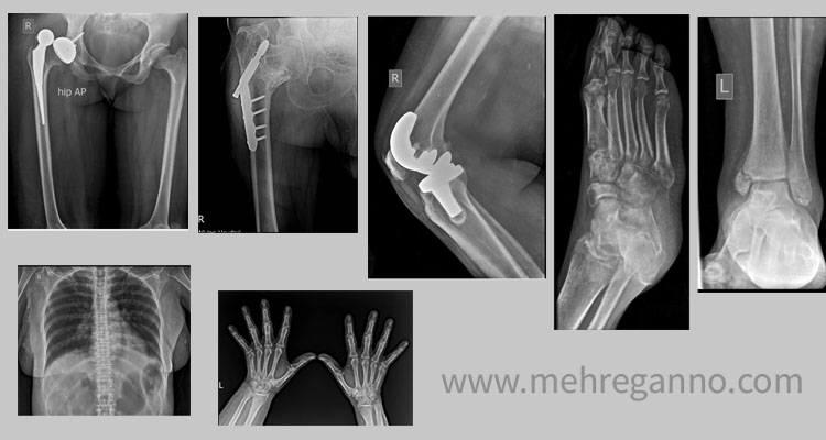خدمات رادیولوژی در منزل کرج