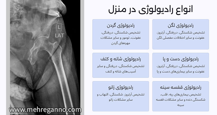 انواع رادیولوژی در منزل